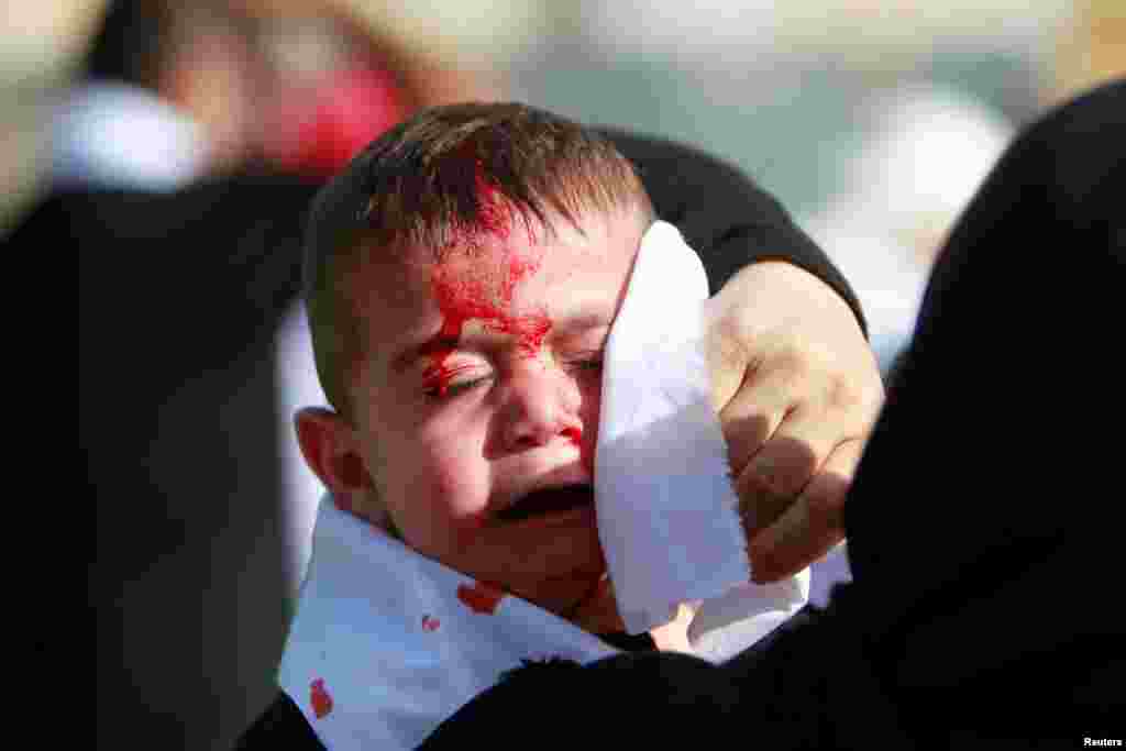 A Shi'ite Muslim child reacts as he bleeds after he was cut on the forehead with a razor during a religious procession to mark Ashura in Nabatiyeh town, southern Lebanon.