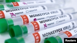 Tabung reaksi berlabel "Virus cacar monyet positif dan negatif" terlihat dalam ilustrasi ini yang diambil pada 23 Mei 2022, sebagai ilustrasi. Satu kasus terduga cacar monyet pada Rabu (3/8) di Jawa Tengah akhirnya terkonfirmasi negatif. (Foto: REUTERS/Dado Ruvic)