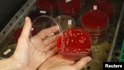 FILE - An employee displays MRSA bacteria strain - a drug-resistant 'superbug' - inside a petri dish containing agar jelly for bacterial culture in a microbiological laboratory in Berlin, March 1, 2008.