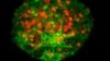 Spheres of cultured papillae cells from human hair follicles successfully produced new human hair when transplanted between the dermis and epidermis of human skin. (Claire Higgins/Christiano Lab at Columbia University Medical Center)