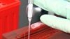 Tuberculosis vaccine research at Vaccine Discovery at Aeras