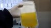 Terapi plasma konvalesen, donor plasma dari penyintas Covid-19 ditengarai menjanjikan penyembuhan bagi penderita virus tersebut. (Foto: AP)