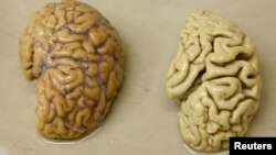 ARSIP - Satu bagian otak yang sehat (kiri) tampak dalam gambar di sebelah bagian otak dari penderita Alzheimer, di unit morfologikal psikopatologi di divisi Neuropsikiatri di Belle Idee University Hospital di Chene-Bourg dekat Jenewa, 14 Maret 2011 (foto: REUTERS/Denis Balibouse)